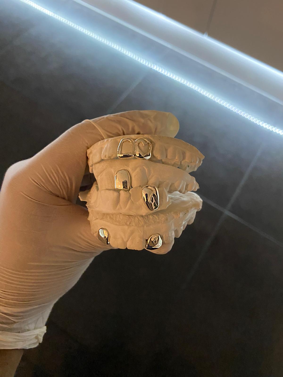 Luxury Custom Grillz