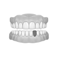 Bottom Lateral