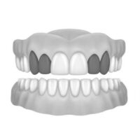 2X Canine & Lateral(Copy)