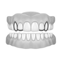 2X Window Canine & Bar